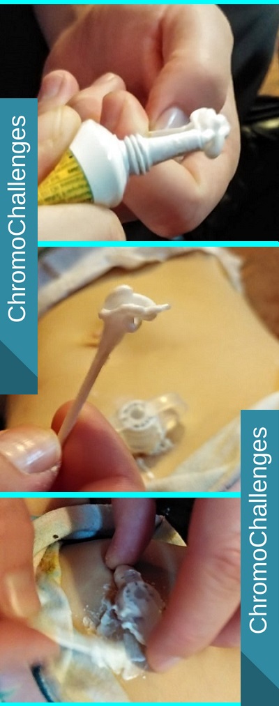 ChromoChallenges Jess Plummer G-tube Change Apply Stoma Meds Q-tip 11
